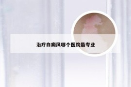 治疗白癜风哪个医院最专业