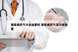 银屑病天气冷会加重吗 银屑病天气湿冷就加重