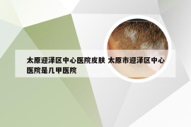 太原迎泽区中心医院皮肤 太原市迎泽区中心医院是几甲医院