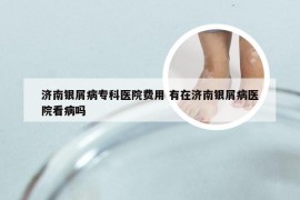 济南银屑病专科医院费用 有在济南银屑病医院看病吗