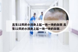 出生12天的小孩身上起一块一块的白斑 出生12天的小孩身上起一块一块的白斑