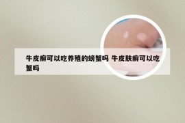 牛皮癣可以吃养殖的螃蟹吗 牛皮肤癣可以吃蟹吗