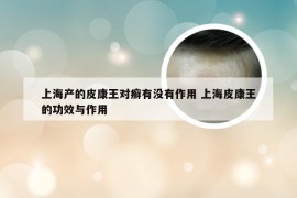 上海产的皮康王对癣有没有作用 上海皮康王的功效与作用