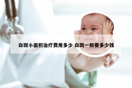 白斑小面积治疗费用多少 白斑一般要多少钱