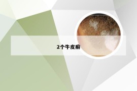 2个牛皮癣