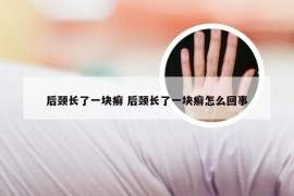 后颈长了一块癣 后颈长了一块癣怎么回事