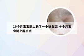 10个月宝宝腿上长了一小块白斑 十个月宝宝腿上起点点