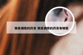 银屑病擦的药膏 银屑病擦的药膏有哪些