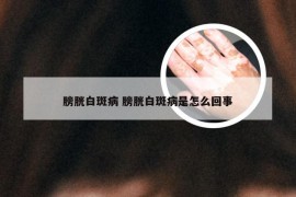 膀胱白斑病 膀胱白斑病是怎么回事