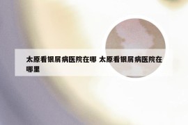 太原看银屑病医院在哪 太原看银屑病医院在哪里
