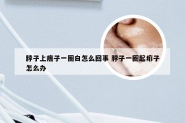 脖子上痦子一圈白怎么回事 脖子一圈起痱子怎么办