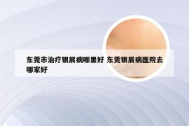 东莞市治疗银屑病哪里好 东莞银屑病医院去哪家好