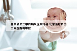 北京公立三甲白癜风医院排名 北京治疗白斑三甲医院有哪些