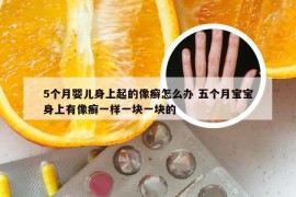 5个月婴儿身上起的像癣怎么办 五个月宝宝身上有像癣一样一块一块的