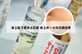 身上起了很多小红癣 身上长一小片红癣还痒