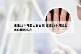 宝宝17个月脸上有白斑 宝宝17个月脸上有白斑怎么办