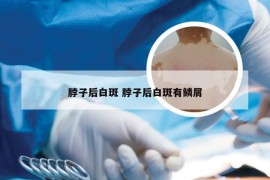 脖子后白斑 脖子后白斑有鳞屑