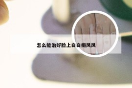 怎么能治好脸上白白癜风风