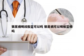 银屑病喝绞股蓝可以吗 银屑病可以喝板蓝根吗
