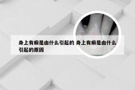 身上有癣是由什么引起的 身上有癣是由什么引起的原因