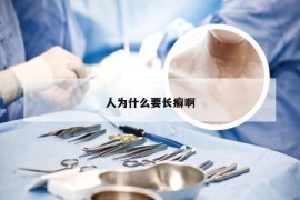 人为什么要长癣啊
