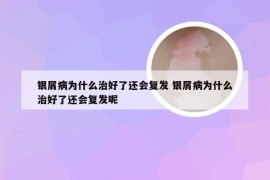 银屑病为什么治好了还会复发 银屑病为什么治好了还会复发呢