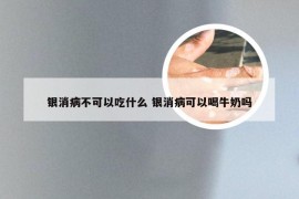 银消病不可以吃什么 银消病可以喝牛奶吗