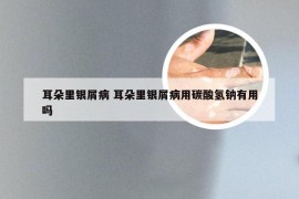 耳朵里银屑病 耳朵里银屑病用碳酸氢钠有用吗