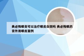 典必殊眼膏可以治疗眼皮白斑吗 典必殊眼药膏外用眼皮案例
