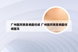 广州医院银屑病最权威 广州医院银屑病最权威医生