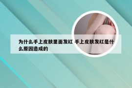 为什么手上皮肤里面发红 手上皮肤发红是什么原因造成的