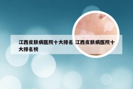 江西皮肤病医院十大排名 江西皮肤病医院十大排名榜