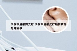 头皮银屑病做光疗 头皮银屑病光疗后有黄茄是咋回事