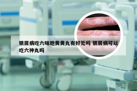 银屑病吃六味地黄黄丸有好处吗 银屑病可以吃六神丸吗