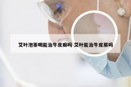 艾叶泡茶喝能治牛皮癣吗 艾叶能治牛皮屑吗