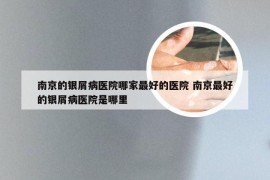 南京的银屑病医院哪家最好的医院 南京最好的银屑病医院是哪里