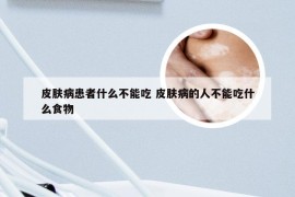 皮肤病患者什么不能吃 皮肤病的人不能吃什么食物