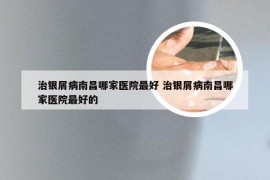 治银屑病南昌哪家医院最好 治银屑病南昌哪家医院最好的