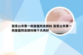 张家口市第一附属医院皮肤科 张家口市第一附属医院皮肤科哪个大夫好