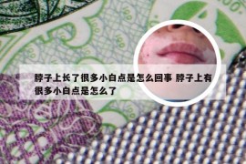 脖子上长了很多小白点是怎么回事 脖子上有很多小白点是怎么了