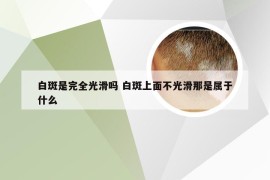 白斑是完全光滑吗 白斑上面不光滑那是属于什么