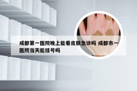 成都第一医院晚上能看皮肤急诊吗 成都市一医院当天能挂号吗