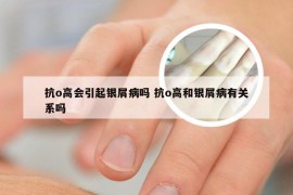 抗o高会引起银屑病吗 抗o高和银屑病有关系吗