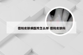 德阳皮肤病医院怎么样 德阳皮肤科