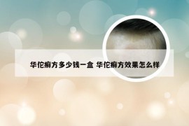 华佗癣方多少钱一盒 华佗癣方效果怎么样