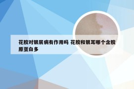 花胶对银屑病有作用吗 花胶和银耳哪个含胶原蛋白多