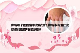 廊坊哪个医院冶牛皮癣较好 廊坊市有治疗皮肤病的医院吗的短视频