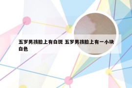 五岁男孩脸上有白斑 五岁男孩脸上有一小块白色
