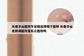 长春华山医院牛皮癣选择哪个医师 长春华山皮肤病医院是私立医院吗