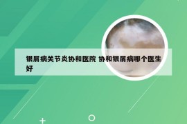 银屑病关节炎协和医院 协和银屑病哪个医生好